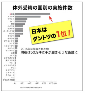 体外受精